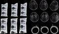 BOOT KIT I/B O/B MSE 6PK