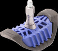 RIM LOCK LITE LOC II 1.60